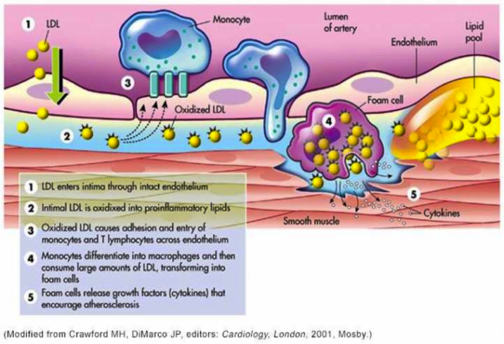 ldl_mechanisms-oxidation-in-vessel-wall