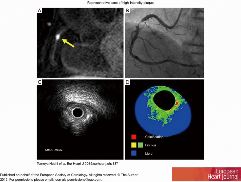 mri cad 9218-PB5-R1