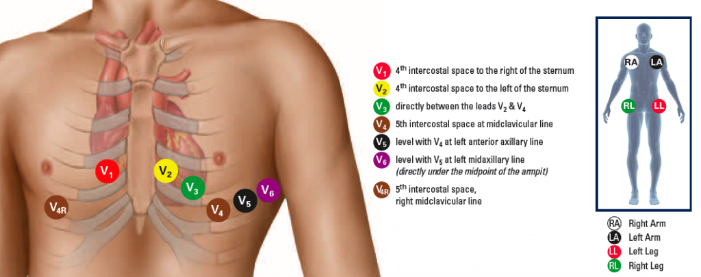 heart EMS-Chest-L