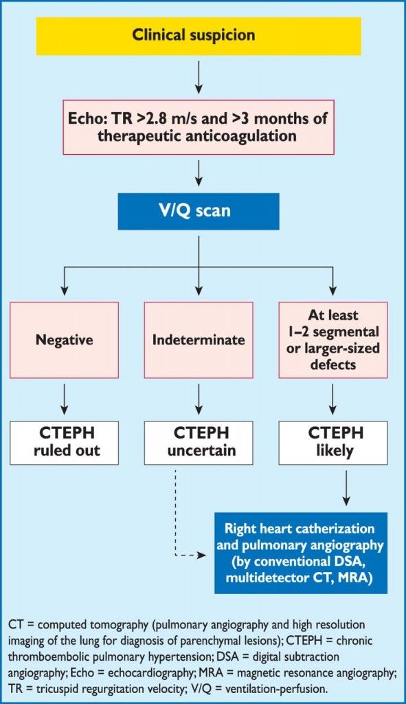 vte 67F6.large