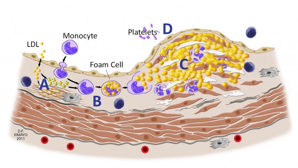 cer AL-Feb-CARDIOLOGY-Figure