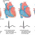 heart figure-40-03-05