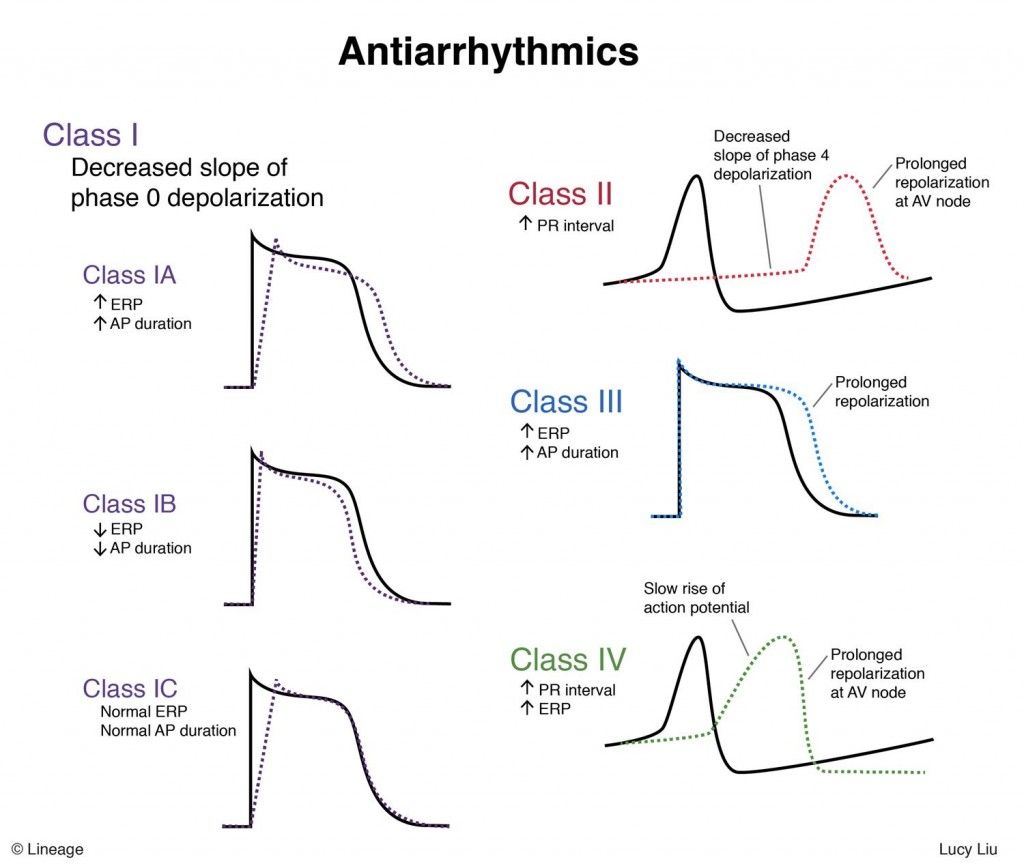 arry 01222017llstep12antiarrhythmics